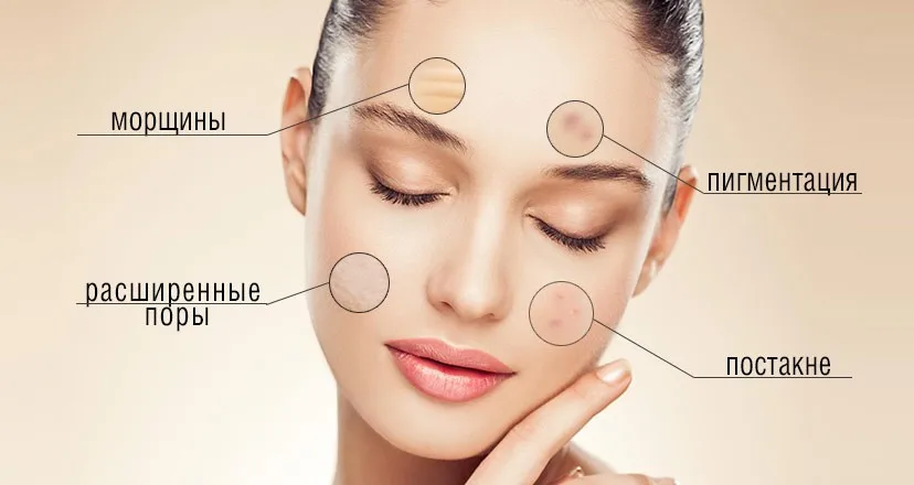 Уход за кожей пор- вакуума для удаления угрей Acne прыщ удаления вакуумных инструмент лицо чистке лица Diamond Дермабразия Машина