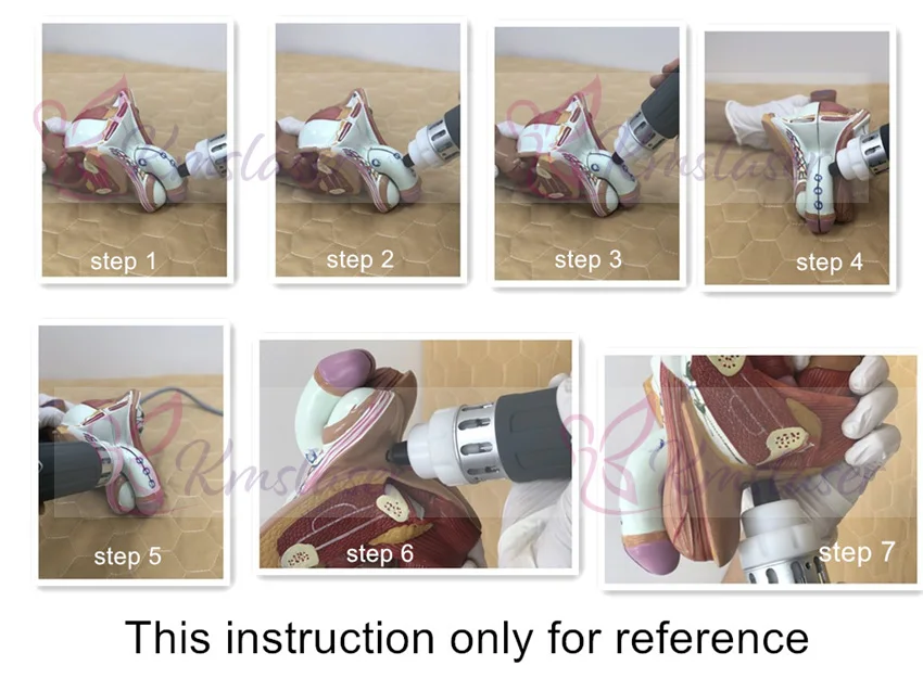ESWT Shockwave ed shock wave терапия купить эрекция дисфункции экстракорпоральная шоковая волна терапевтическое оборудование