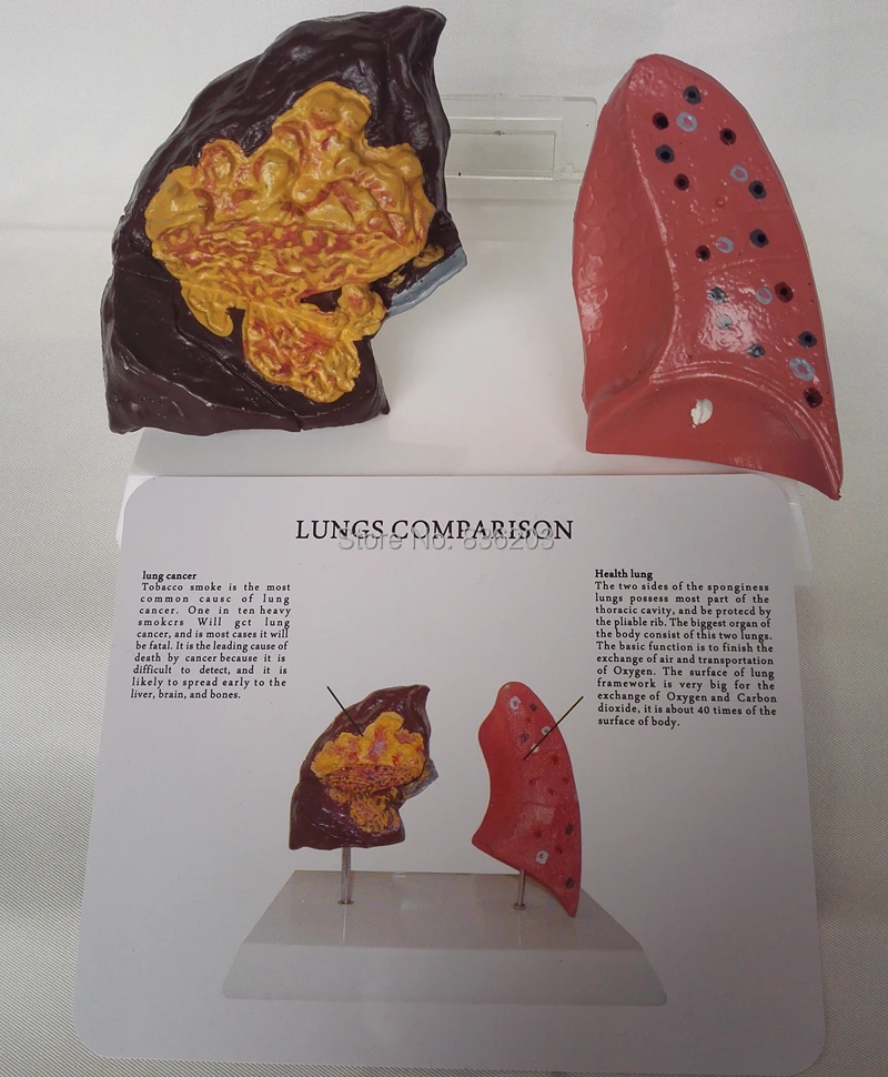 Медицинский шприц для обучения при раке легких|lungs model|human lung modelmodel lungs |