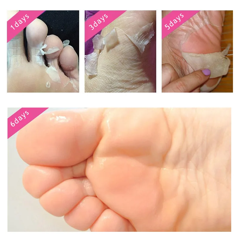 

Exfoliating Peel Foot Mask Baby Soft Feet Remove Hard Dead Skin Callus Feet Care 88
