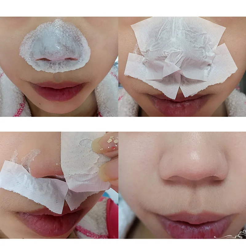 Hot Sale Nose Blackhead Black Head Remover Cream Aloe Vera Healing Gel Skin Burns Damage Repair Mask Skin Care