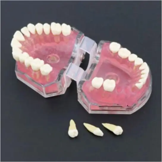 

Dental Teeth Model Study Teach Standard Model with Removable Teeth