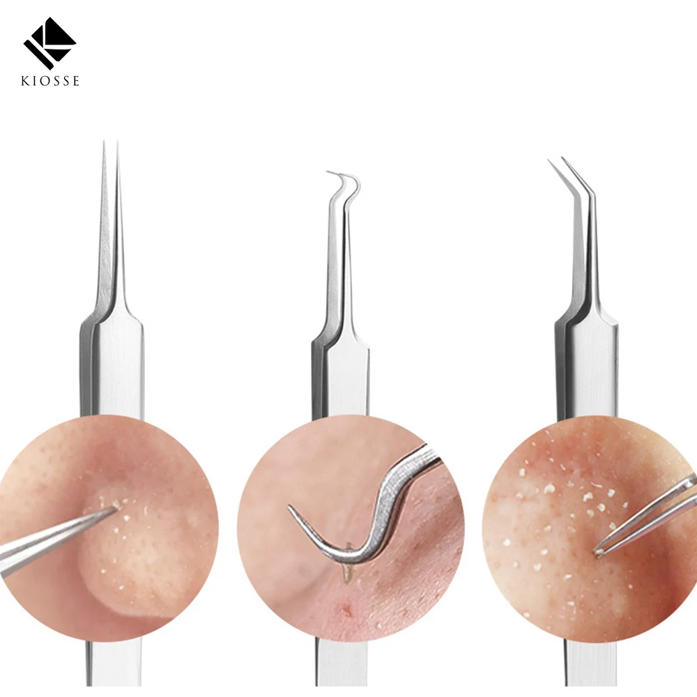 Новые игольчатый Пинцет для прыщей черная голова цыпок острым изгиб Gib голову