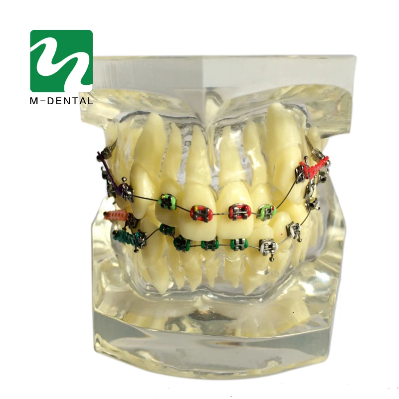 1 шт. Стоматологическая Ортодонтическая модель для обучения прозрачная с