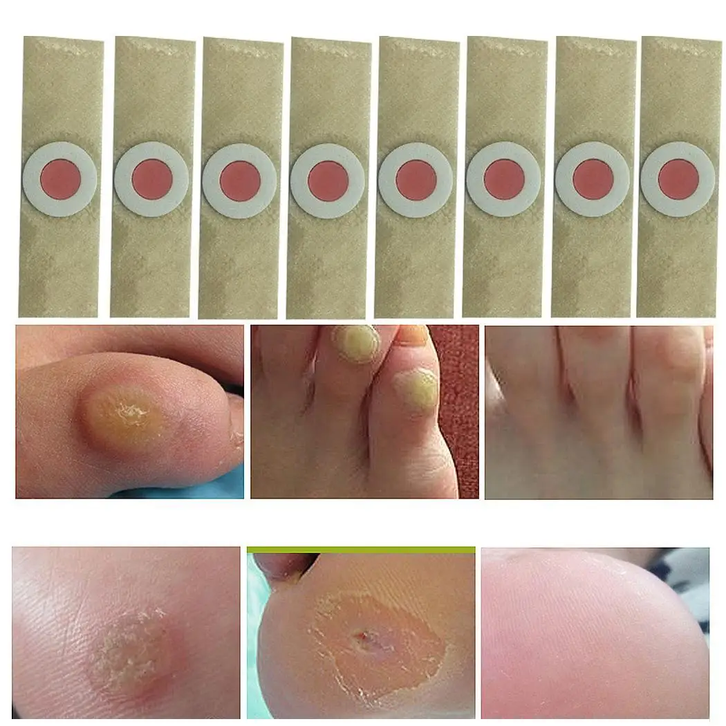 50 шт. кукурузный пластырь безболезненное средство для удаления кукурузы уход за