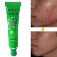 30g high quality face cream beauty product face skin repairing acne cream oil control acne remover facial skin care tool