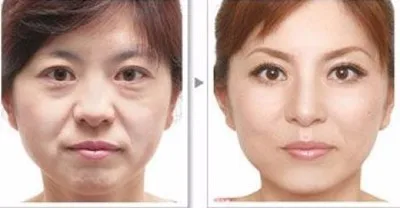 Растительные ингредиенты для ухода за глазами средство удаления темных кругов и