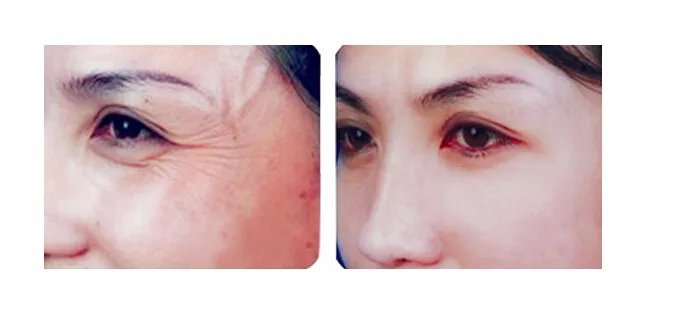 Бесплатная доставка Q10 эссенция Золотая маска для глаз коллагеновая кристальная