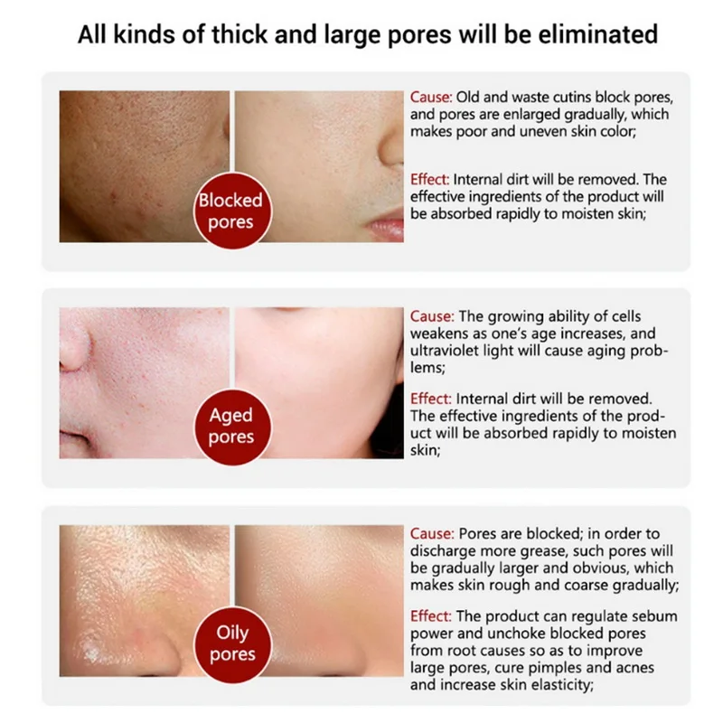 LANBENA Красота кожи сыворотка пор отбеливание ярче до черного 15 мл для женщин