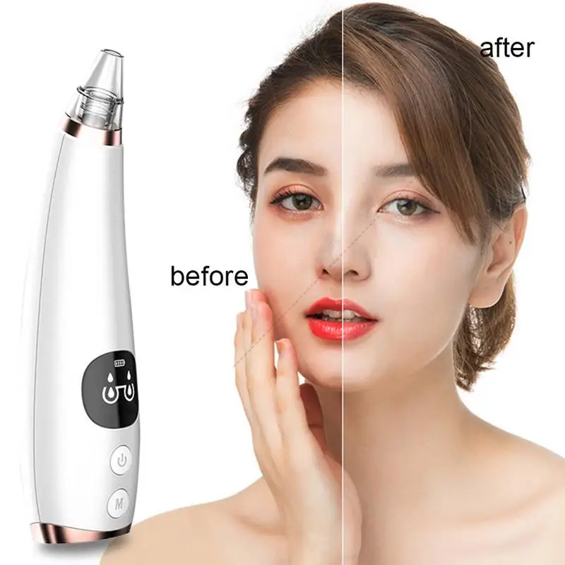 Уход за кожей Blackhead дропшиппинг по сниженной цене лица глубокие поры акне