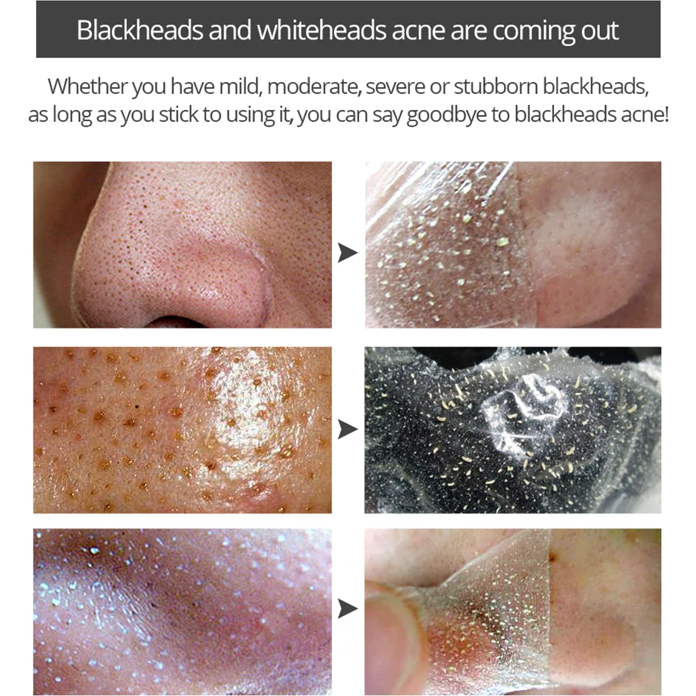 Яркий гламурный удаления черных точек для носа и лица глубокие маски Очищающая
