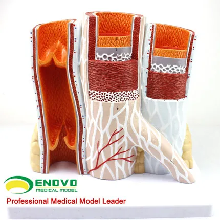 

Arterial venous anatomical model arteriovenous structure