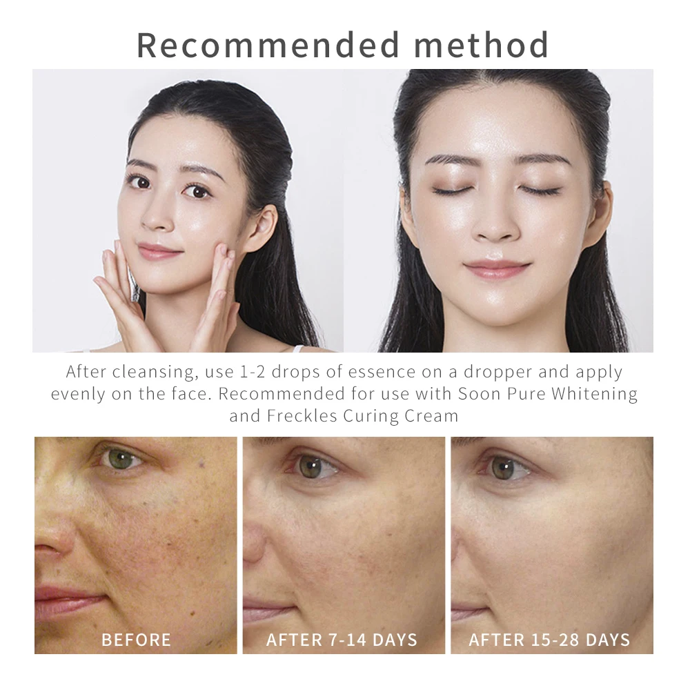 Крем для макияжа soonpure отбеливание веснушек эссенция омолаживающая сыворотка для лица меланин крем для удаления веснушек пятнистый твердый уход за лицом увлажнение уход за кожей