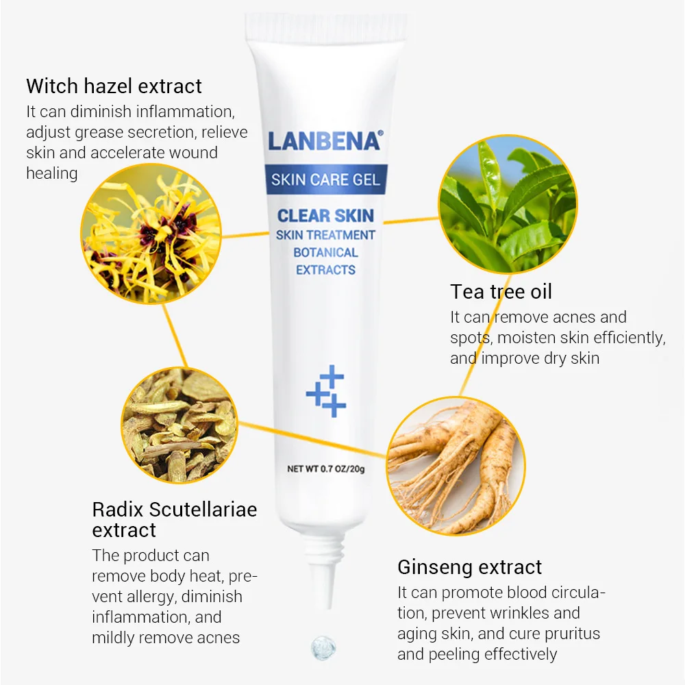Scar Removal Acne Facial Cream Treatment Fade for Face and Body | Красота и здоровье
