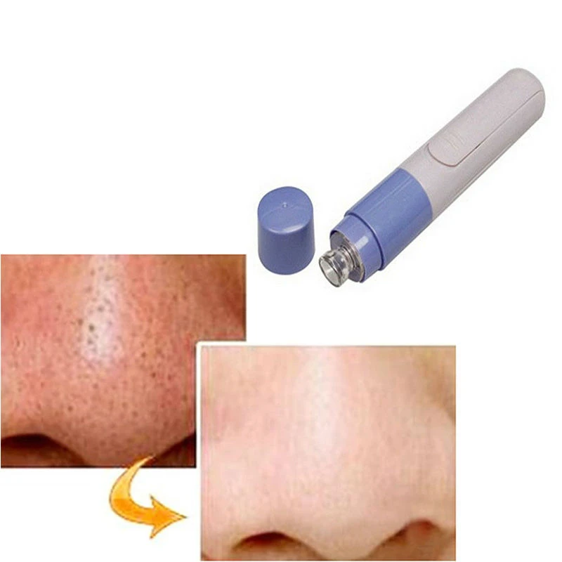 Электрический Очиститель пор для лица очиститель кожи лицо грязь сосать вакуум