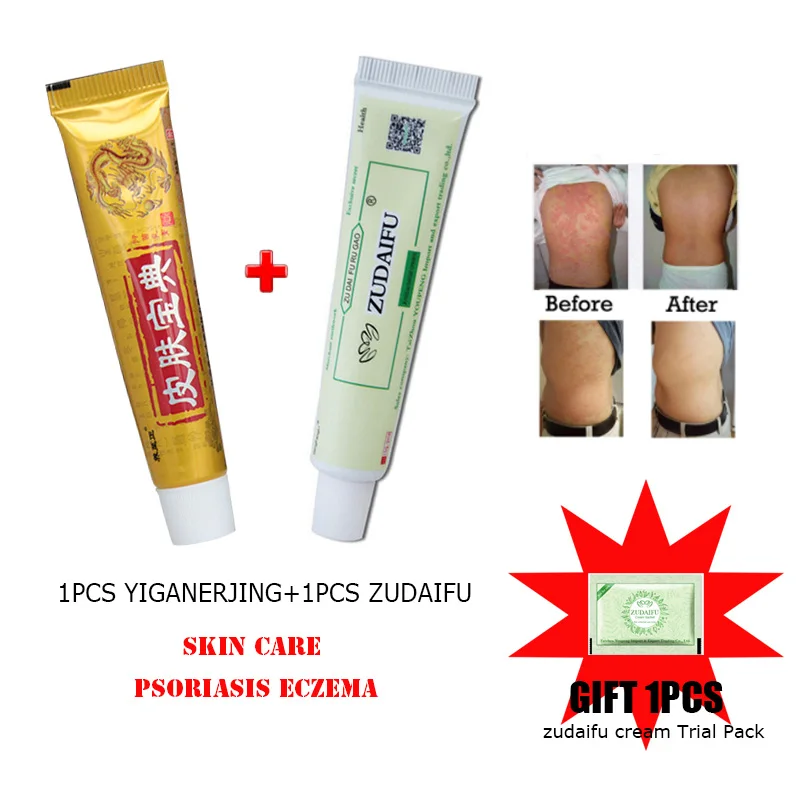 1 шт. YIGANERJING + ZUDAIFU костюм для ухода за кожей крем от псориаза дерматит экзема зуда