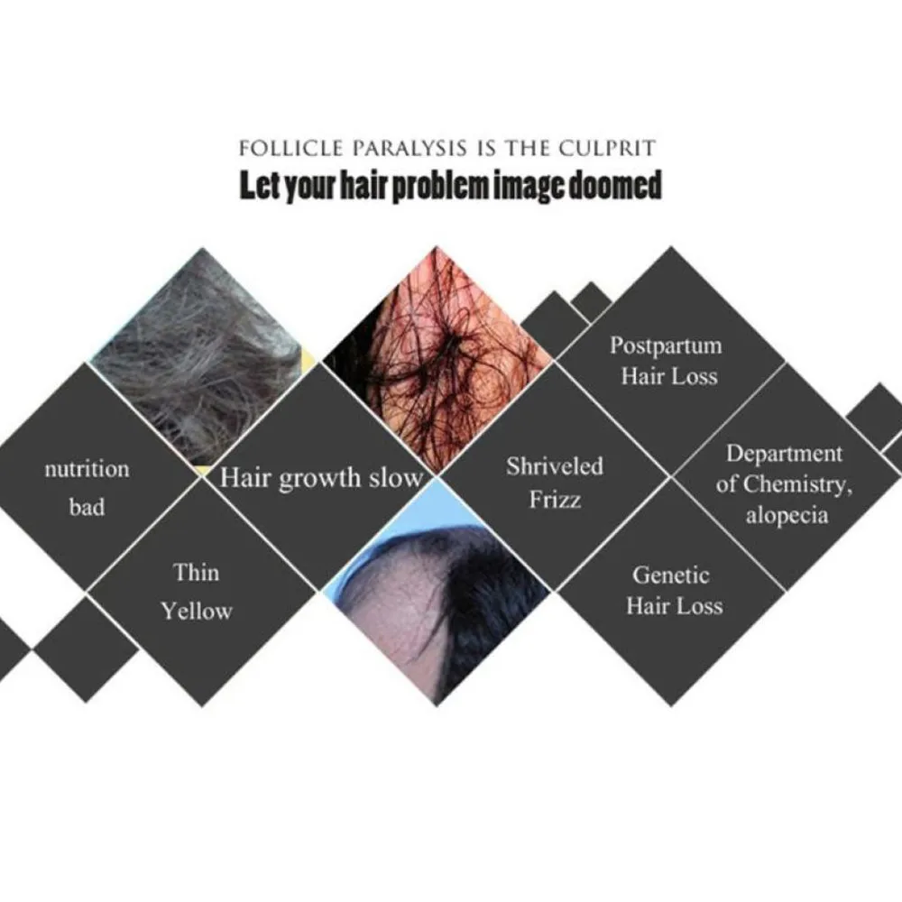 Эссенция для роста волос Antera масло быстрого лечение выпадения натуральных