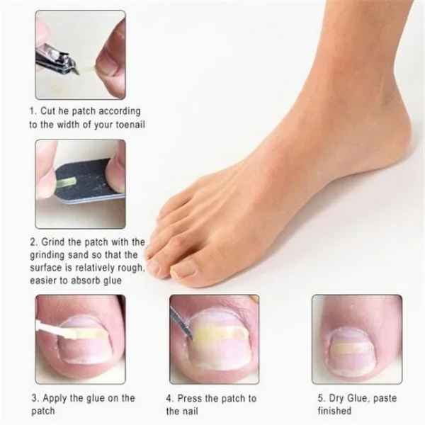 10 шт. инструменты для обрезки ногтей с кусачками и ножками|Средства ухода за