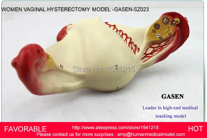 Модель матки модель генитальной анатомии учебная медицинская планирования