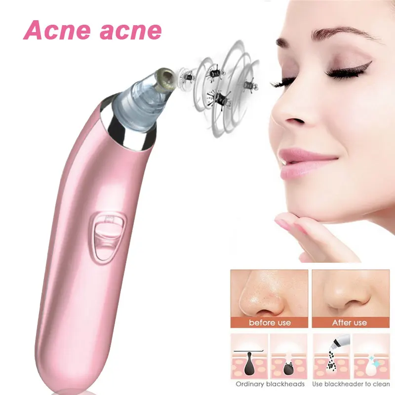 2019 капельница розовый Очищающий Инструмент для лица очиститель эффективная