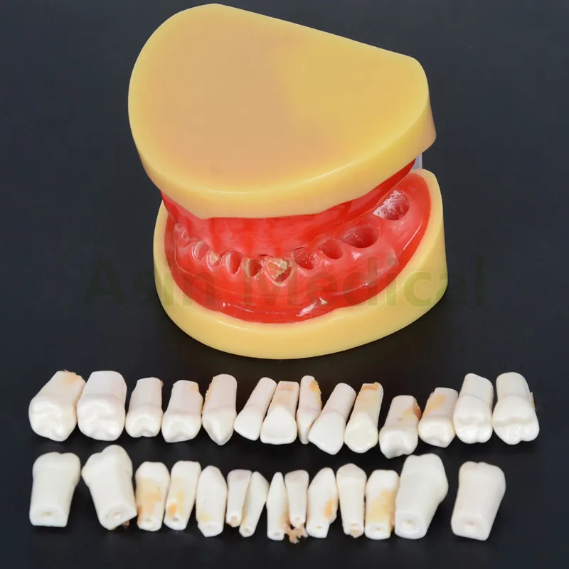 New Arrival Dental All teeth Removable Standard Teeth Tooth Model 28 pcs student learning model | Красота и здоровье