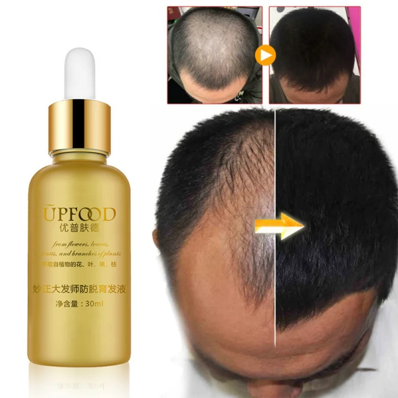 30 мл уход за жидкими волосами против выпадения волос Эфирные масла для роста
