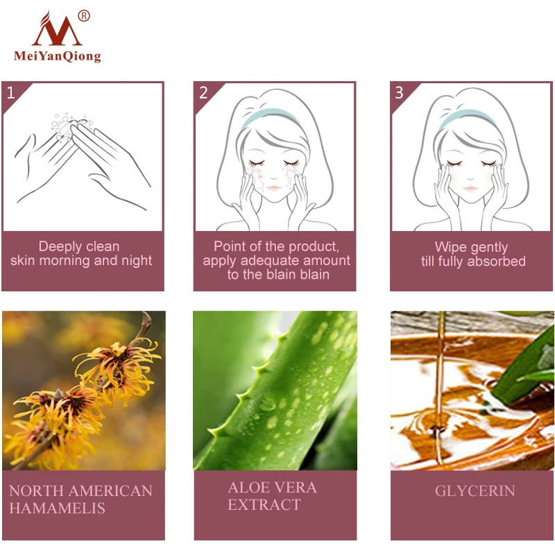 Высокоэффективное травяное Очищение лица от акне средство для удаления рубцов