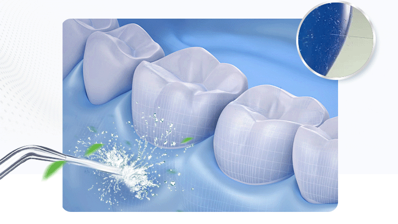 Waterpik WF-03EC Cordless Freedom Dental Water Flosser White 150ML Water Flossing Teeth Cleaner With 3 Jet Tips and Storage Case