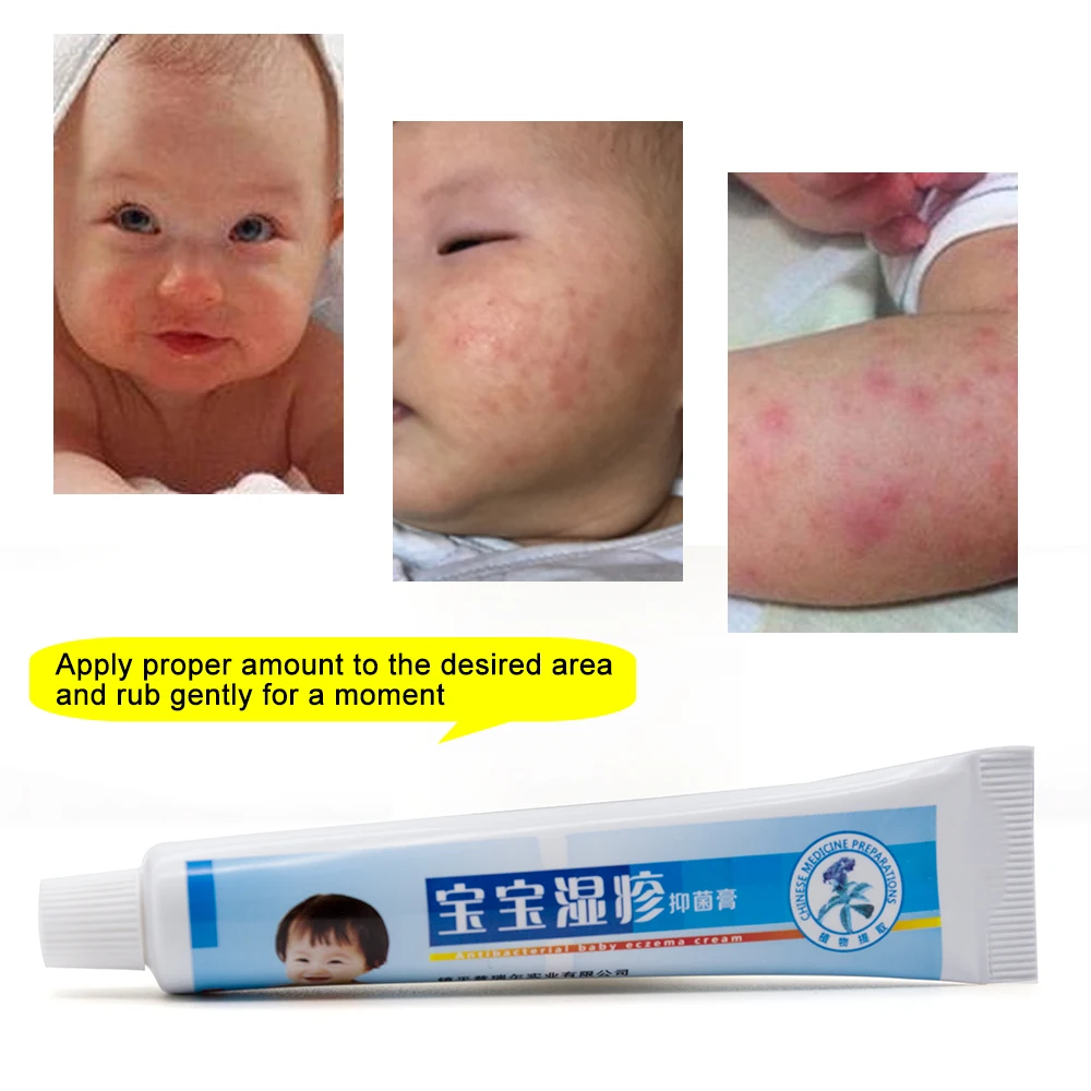 1 шт. детский Eczema крем от псориаза Pruritus дерматит зуд ремонт кожи Китайский