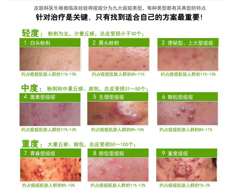 New Aloe Acne Vulgaris Scar Whelk Pimple Zit Zun Remove Vanishing Dispelling Plaster Cream Skin Care Treatment Face Care
