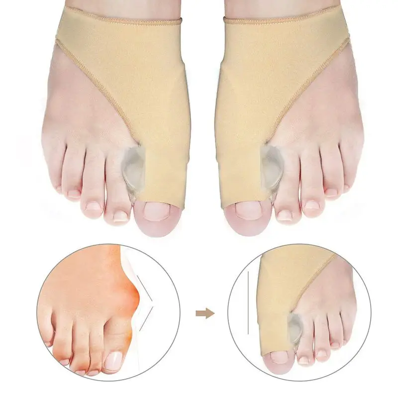 Корректор Bunion и набор для снятия мозолей лечение боли в большом суставе пальцев