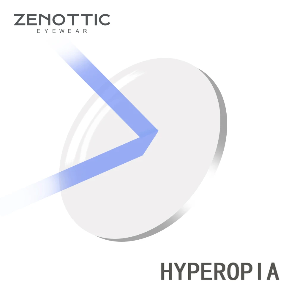 ZENOTTIC по рецепту, прогрессивный стандарт Blu-Ray объектив 1,56 1,61 1,67(+ 12,00~-12,00) при дальнозоркости, близорукость дальнозоркость, оптические линзы - Цвет линз: Hyperopia