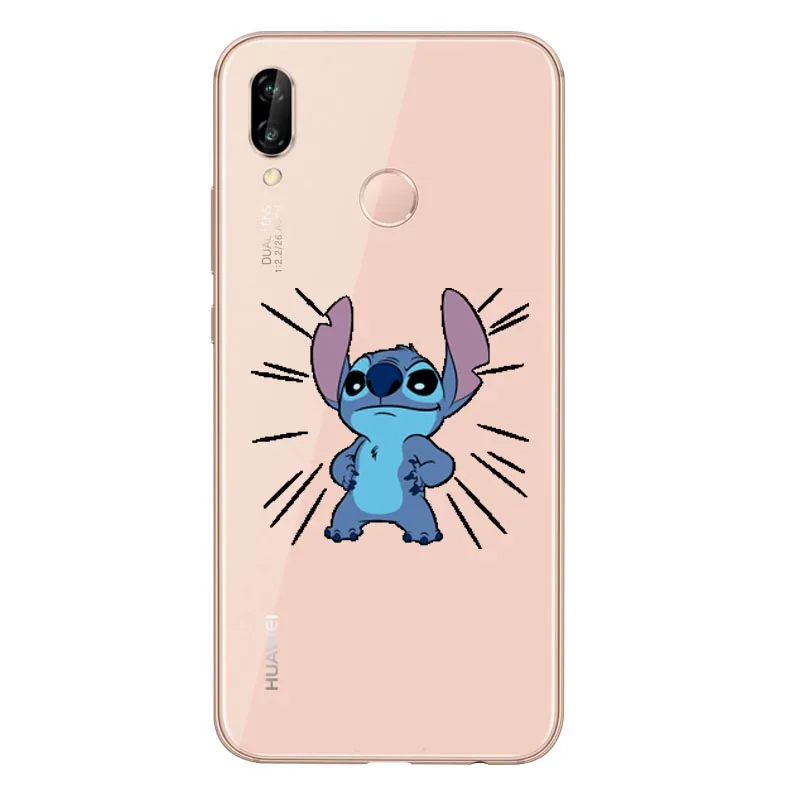 Забавный чехол для стежка мягкий из ТПУ телефона красного риса NOTE5pro Xiaomi MI 6PLUS 8 5