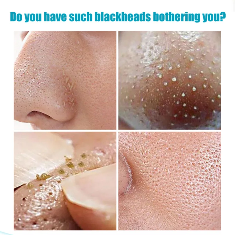 Green Tea Cleansing Mask Blackhead Remover Deep for Acne Scars Blemishes Skin Care YUF99 |