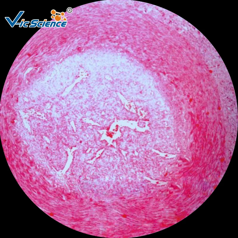 Медицинские науки 100 шт патологии человека Горки Набор|pathology slides|set 10set medic |