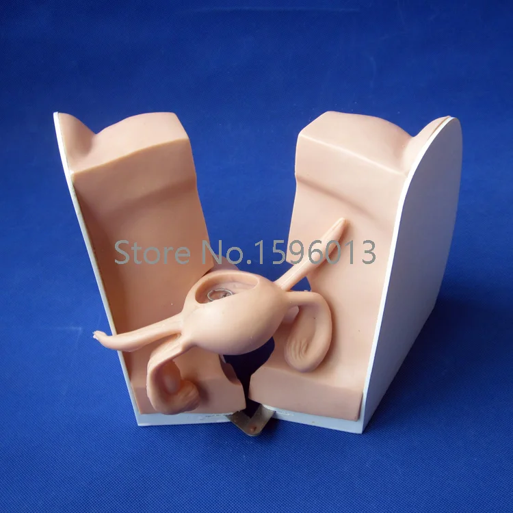 Усовершенствованная модель контрацепции противозачаточная помощь | Канцтовары