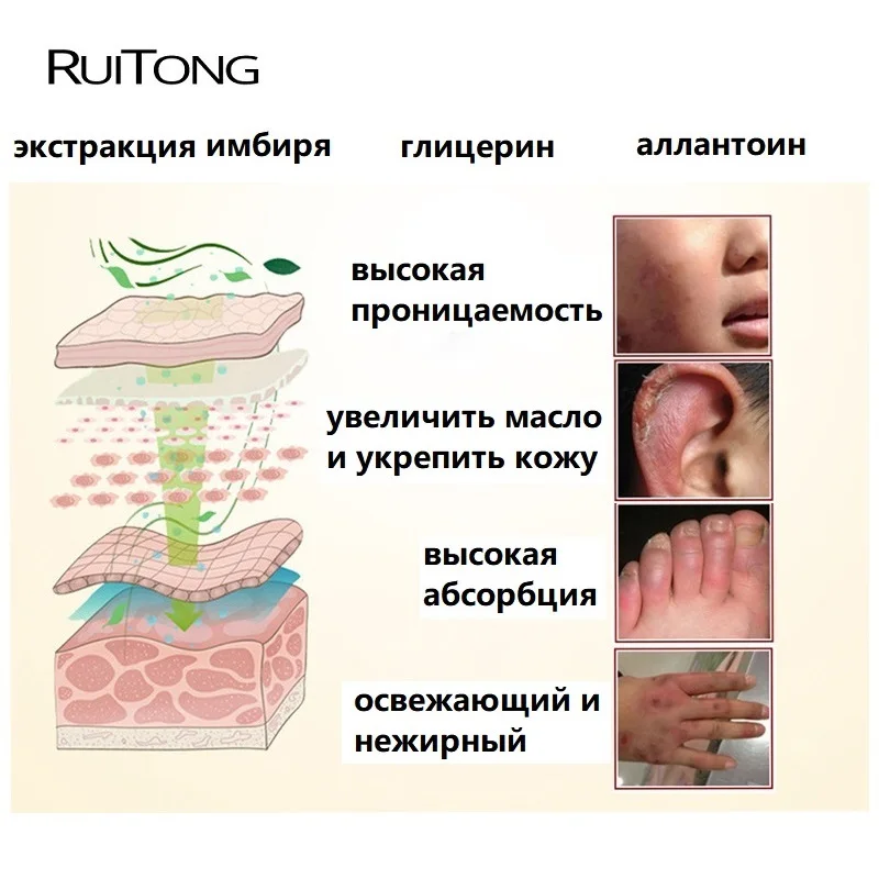 5 шт./лот крем для замороженного растрескивания Восстанавливающий кожу сухой