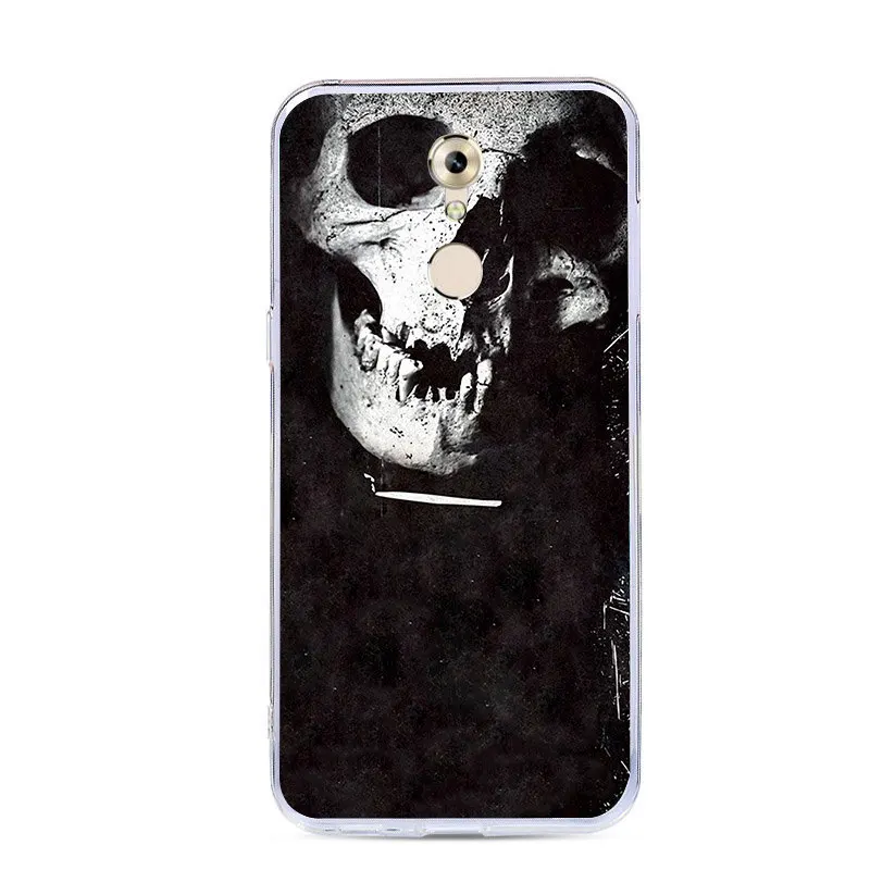 J&ampR Drawing Phone Case For ZTE Axon 7 Mini Silicone Soft Cover Cute Animal Printing Patterned 7Mini Cases |