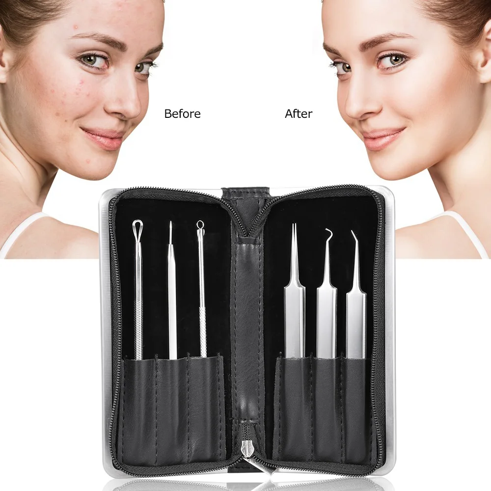 6 шт. пинцет для удаления чёрных точек|extractor comedon|extractor cleanerextractor remover |
