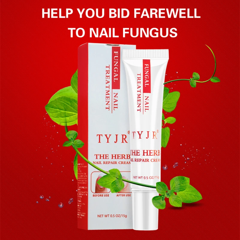 Nail Treatment Care Essence Whitening Removal Gel Fungal Cream | Красота и здоровье