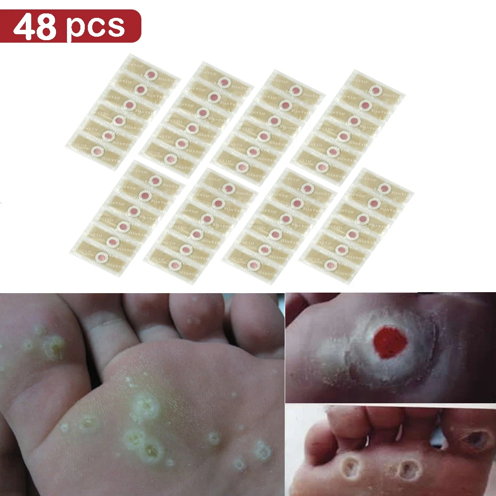 

48pcs Foot Plaster Corn Removal Remover Warts Thorn Plaster Health Care For Relieving Pain Calluses Plaster Medical Plaster