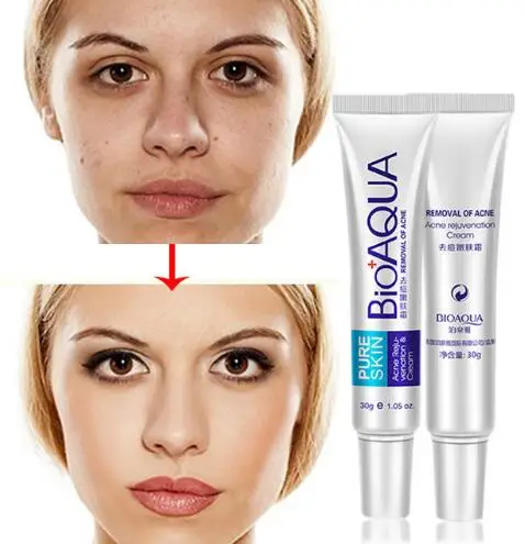 Bioaqua 30 г анти акне крем/масло Управление/уменьшить поры/для удаления рубцов после