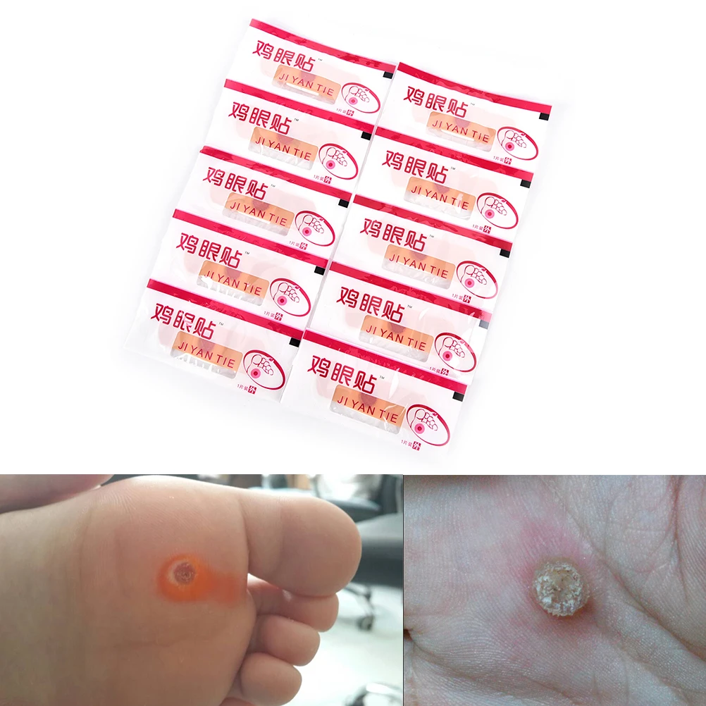10 шт. удаление кукурузы для рук омертвевшей кожи Pedi Cure Care Китайская традиционная