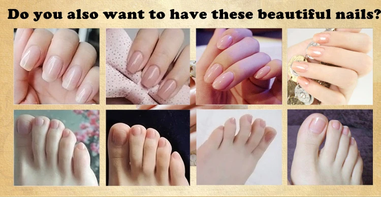 Dimollaure грибковый гель для ухода за ногами эссенция гладкий носок удаления грибка