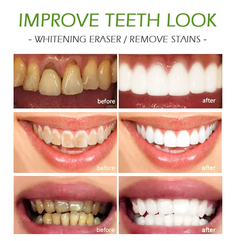 Отбеливающая зубная паста сыворотка для удаления зубного налета средство