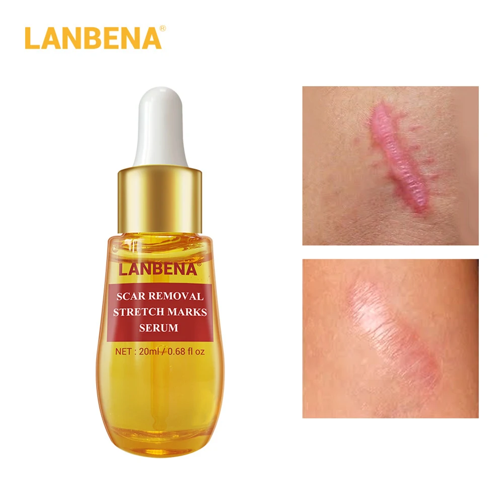 LANBENA сыворотка для удаления шрамов растяжек фототерапия уменьшение пор кожи