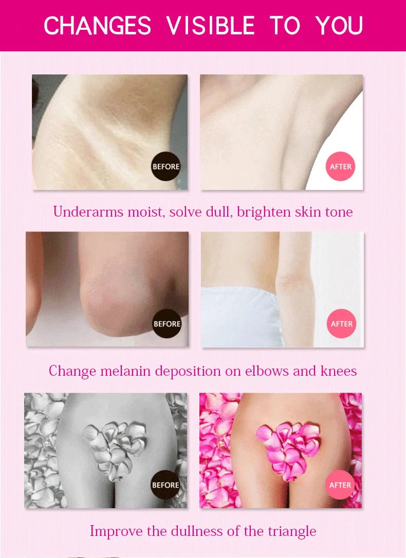 Горячая Aichun Beauty крема для тела отбеливающий крем для подмышек между ногами, коленями, частые части, отбеливающая формула, отбеливатель подмышек, интимный