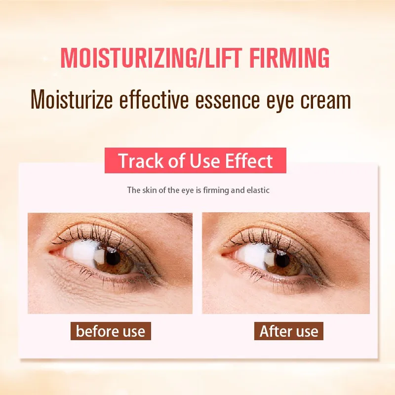 Средство для увлажнения и отбеливания кожи вокруг глаз от морщин|cream eyes|eye whitenereye
