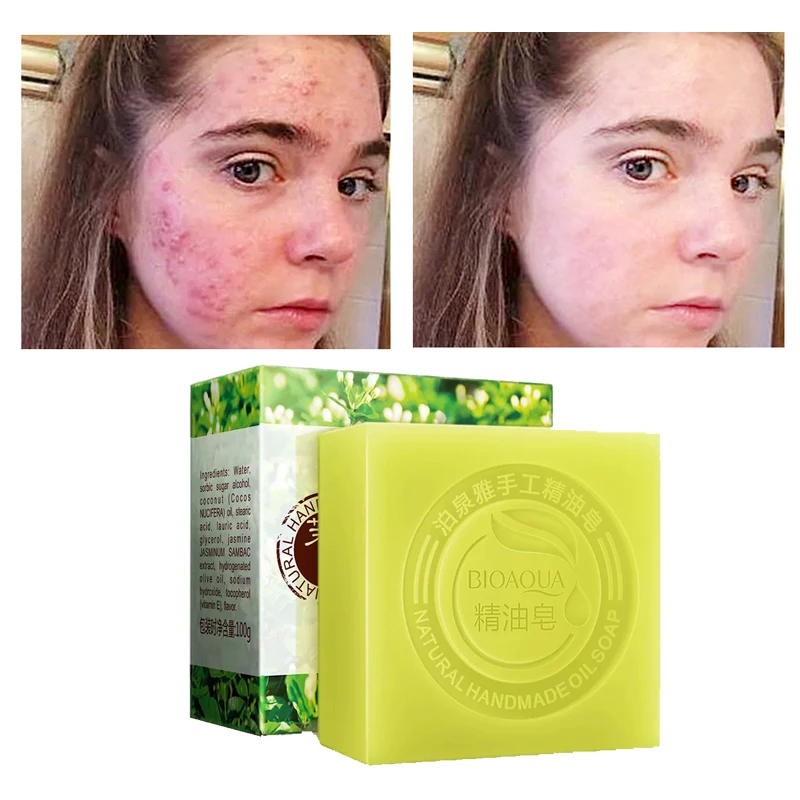 Отбеливающее мыло отбеливание кожи Kojic кислота ручной работы осветляющие прыщи