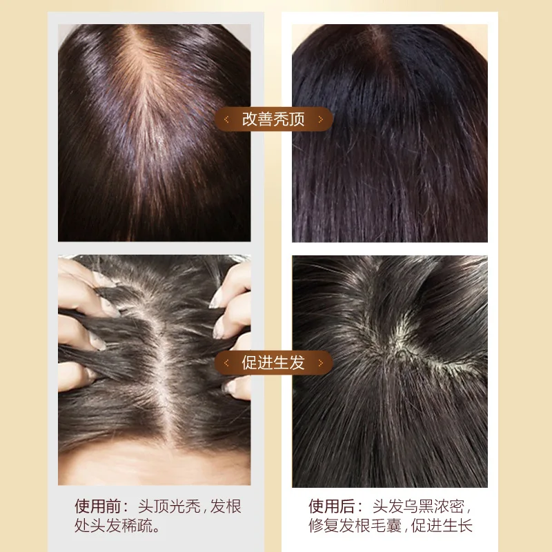 1pc pilatory stop hair loss fast growth products for men and woman essence grow restoration 30ml | Красота и здоровье
